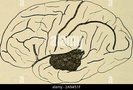 Organic and functional nervous diseases; a text-book of neurology . (Eichhorst.) (Claus.) Stock Photo