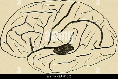Organic and functional nervous diseases; a text-book of neurology . (Girandeau.) (Vernicke.). Stock Photo