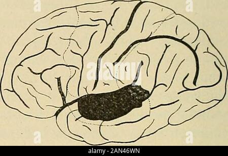 Organic and functional nervous diseases; a text-book of neurology . (Girandeau.) (Vernicke.) Stock Photo