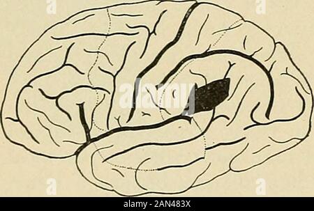 Organic and functional nervous diseases; a text-book of neurology . (Henschen.) (Pick.). Stock Photo