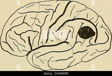 Organic and functional nervous diseases; a text-book of neurology . (Dejerine.) (Jfacewen.). Stock Photo