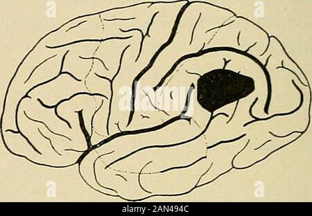 Organic and functional nervous diseases; a text-book of neurology . (Dejerine.) (Jfacewen.) Stock Photo