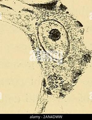 Trattato delle malattie mentali . Fig. 32. — Cellule di Betz gravemente atrofiche in un caso di sclerosi lateraleamiotrofica (da Franceschi). chessia. Ed è caratteristico di simili processi che lalterazione sinizia edè ad ogni modo più grave nellestremità terminale della fibra, e chessa t. Stock Photo