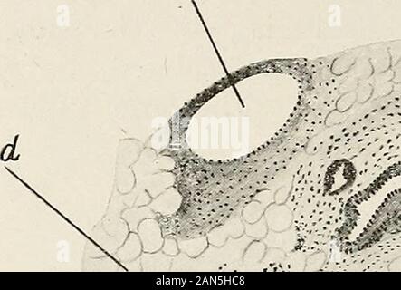 Gynaecology for students and practitioners . the seat of superficial ulcers due to venous stasis and friction.Usually they are firm and hard, but may undergo myxomatous orcalcareous degeneration. They cause no symptoms except those dueto their bulk, and they are easily removed by dividing the pedicleand tying the vessels it contains. Lipoma is a rarer form of new growth than fibroma. It may occurin the greater labia either as a pediculated, or an encapsuled, or adiffuse growth. Papillomata. These frequently occur upon the skin-surfaces incases of chronic gonorrhoea {see p. 292). Teratomatous C Stock Photo