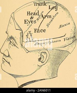 Brain surgery . Fig. 10.—The lines indicating the fissures of Rolando and Sylvius laid down on theskull according to the rules given in the text and the relative situation of the func-tional areas of the cortex to these lines : the right hemisphere. To find the fissure of Rolando, lay down a line fromthe root of the nose to the occipital protuberance overthe top of the head, and take a point 0.557 of thedistance back upon this line. This point will corre-spond to the upper end of the fissure. The fissuremakes an angle of 67° with the median line just THE DIAGNOSIS OF CEREBRAL DISEASE. 17 measu Stock Photo