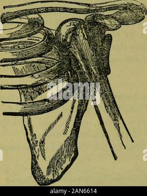 The hydropathic encyclopedia: a system of hydropathy and hygiene .. . DOWNWARD LUXATION. 090 SURGERY head, which, when the arm is rotated, can be observed to move. Theelbow is thrown further back than in tho downward luxation, the armis much shortened, and there is great difficulty in moving the arm inany direction.In the backward luxatbn, fig. 222, the projection of the head of the Fig. 821. Fig. 829. Stock Photo