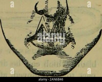 The hydropathic encyclopedia: a system of hydropathy and hygiene .. . nths. While removing thedressings the patient must be placed in the position before described,and the walls of the abdomen firmly held by an assistant, so that nomotion be allowed to interrupt the adhesive process. CHAPTER VIII. DEFORMITIES. The deformities which result from accident, disease, or maconforma-tion, are innumerable; but an understanding of the principles whichapply to the management of those which are common, will readilyluggest the modifications applicable to unusual cases. Hare-Lij—Labium Leporinum.—This is a Stock Photo