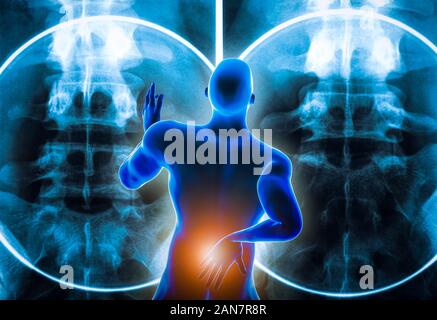 Back view of a man suffering from an acute lumbar back pain or discal hernia or lumbago with backbone x-ray imagery in the background. 3D rendering il Stock Photo