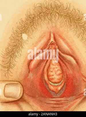 A textbook of obstetrics . 3. Stock Photo