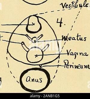 Cloacal morphology in its relation to genito-urinary and rectal diseases(With 54 plates and 93 illustrations.) . rtMettWl Plate 1.—Evolution of the Cloaca. begin in the cloacal aperture into the definitive anus and the urino-genital sinus or pore.Two folds of the lateral walls of the cloaca grow towards each other, until they meetand coalesce, thus forming the perineum. The proctodaeum breaks through into thelumen of the gut, and the cloaca, as such, is no more. These changes are completed oviciujcT . S.. Cloacal Stock Photo