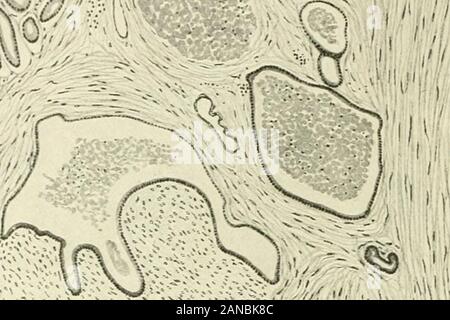 Fibroids and allied tumours (myoma and adenomyoma) : their pathology, clinical features and surgical treatment . &lt;?:^* o ^r-- ? •??•? ,* .1 .^ww M- W / ^ IP ?m CO t .. ?^ - V  sy7^v„:i)i?,v Stock Photo