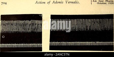 American journal of pharmacy . upon the central nervoussystem in general. The following table is a typical chart of a frogs heart poisoned withadonis. 18 gm, frog, brain pithed and heart exposed.Time. Rate of beat Remarks. per mmute. 1:49 33 1:51 1:54 33 1:55 31 1:58 29 2 :oo 23 2:03 22 2:05 20 2:10 2:12 2 cc. of adonis injected into the lymph sac ofof the leg. The ventricle is paler and contracts morestrongly. Auricles and ventricles beating strongly andin unison. This is the rate of both auricles and ventri-cles. Ventricles have stopped, this is auricular rate.Auricles are still beating, tho Stock Photo