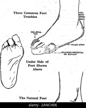 Army Foot Measuring And Shoe Fitting System Prefaced By A