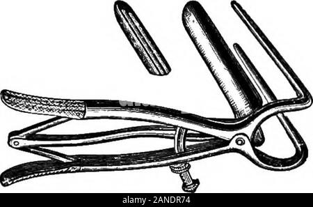 An illustrated encyclopædic medical dictionaryBeing a dictionary of the technical terms used by writers on medicine and the collateral sciences, in the Latin, English, French and German languages . MITTENDORFS EYE SPECULUM. landolts eye speculum.. ntcaises speculum ani. Stock Photo