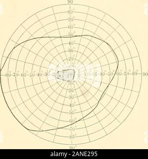 tobacco amblyopia alcohol symptoms JaypeeDigital Tobacco-alcohol optic neuropathy clinical