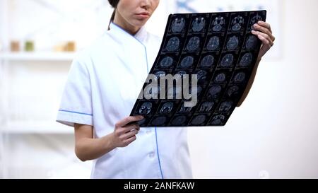 Experienced neurosurgeon looking at brain x-ray, upset with examination result Stock Photo
