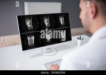 Mature Male Doctor Examining Knee X-ray In Clinic Stock Photo