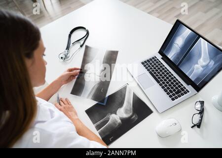 Doctor Looking At Foot X-ray On Laptop With Stethoscope Stock Photo