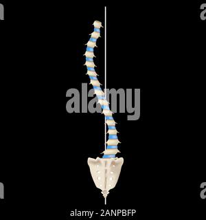 S-shaped scoliosis. Dextroscoliosis. Levoscoliosis. Spinal curvature, kyphosis, lordosis, scoliosis, arthrosis. Infographics. Vector illustration. Stock Vector