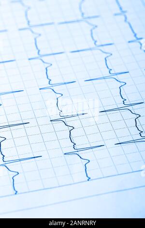 Cardiogram paper closeup Stock Photo