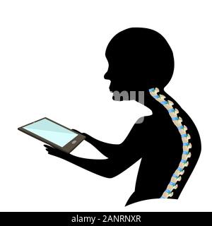 Text Neck Syndrome. Spinal curvature, kyphosis, lordosis of the neck, scoliosis, arthrosis. Improper posture and stoop. Black and white silhouette Stock Vector
