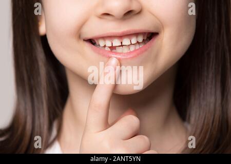 Close up little preschool girl showing growing first permanent molar. Stock Photo