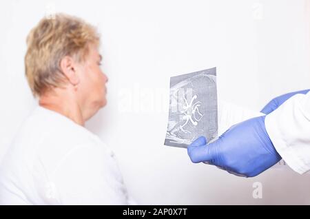 The patient is an elderly woman with a headache at a doctor's appointment. The concept of cerebral arteriosclerosis Stock Photo