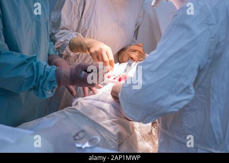 Doctors - children's surgeons, in a sterile operating room, perform a kidney operation. Surgeon's hands holding surgical instruments, manipulate Stock Photo