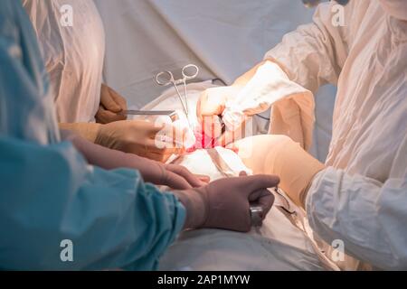 Doctors - children's surgeons, in a sterile operating room, perform a kidney operation. Surgeon's hands holding surgical instruments, manipulate Stock Photo