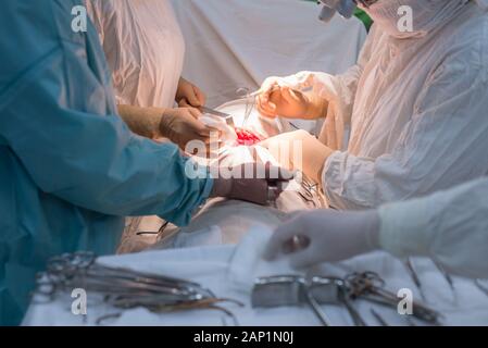 surgical instruments on a sterile table in the operating room. Surgeons work with hands Stock Photo