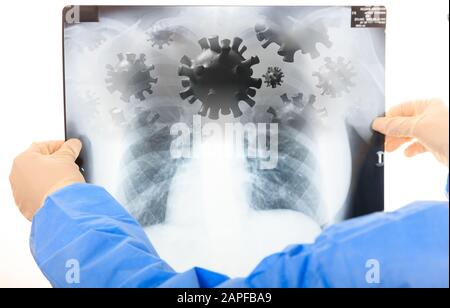 Coronavirus infection, flu respiratory syndrom, doctor holding a lungs Xray, virus infection concept. 3d illustration Stock Photo