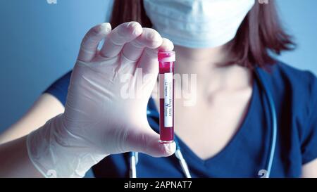 Doctor wearing respirator mask holding in hand positive Coronavirus blood test result. 2019-nCoV biochemical blood analysis in laboratory. Chinese Wuh Stock Photo