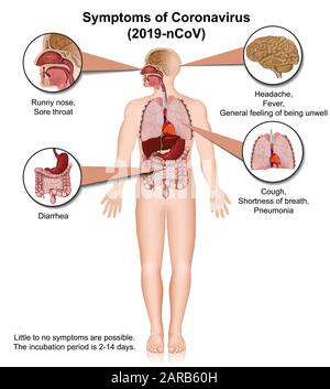 Coronavirus medical vector infographic, symptoms Stock Vector