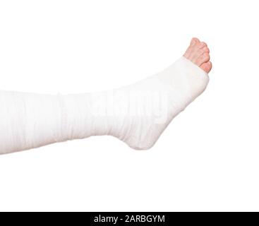 Leg bandaged in a tight dressing, plaster cast for fracture of the