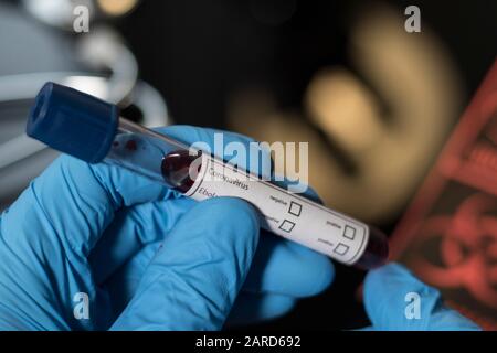 Flu virus hospital blood test. Close up of human blood sample being tested for immune system diseases. Scientists and doctors testing for contagious d Stock Photo