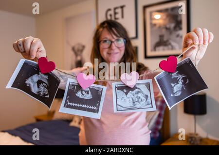 A selective focus view of a happy expectant mother showing four echography, ultrasound, baby scans at different trimesters of pregnancy, with hearts Stock Photo