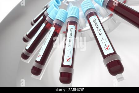 Coronaviruses, group of viruses that cause diseases in mammals and birds. In humans, the virus causes respiratory infections. 3D illustration. Stock Photo