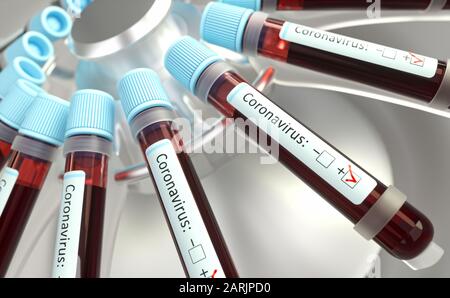 Coronavirus, group of viruses that cause diseases in mammals and birds. In humans, the virus causes respiratory infections. 3D illustration. Stock Photo
