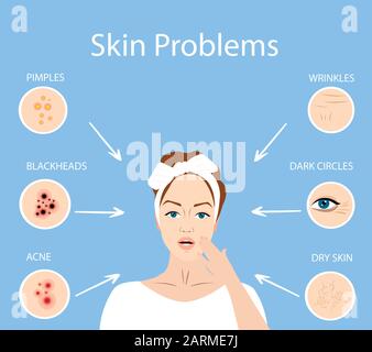 Vector of a worried woman with face skin problems Stock Vector