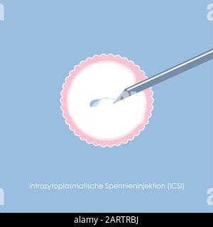 fertility reproduction of ovum and spermatozoon ICSI vector illustration EPS10 Stock Vector