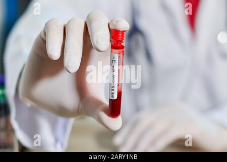 Blood test tube in doctor hand, Mers-CoV Coronavirus test Positive label in hospital blood test tube for analysis. 2019-nCoV virus infection Stock Photo