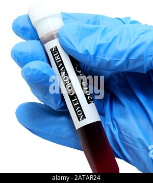 hand of a doctor with blue glove and test tube for blood tests of Coronavirus  on white background Stock Photo