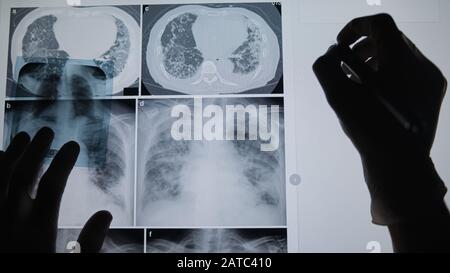 Professional medical team examining a patient's radiography, Medical Concept. Stock Photo