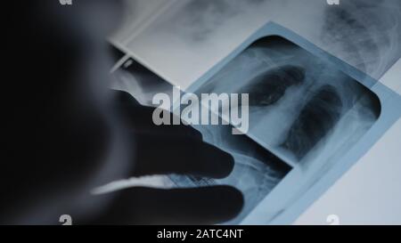 Doctor examining chest x-ray film of patient at hospital. Medical Concept. Stock Photo
