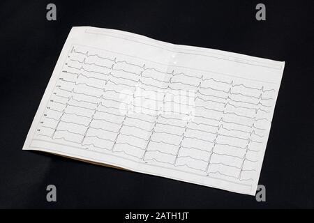 Cardiogram results on a black background closeup Stock Photo
