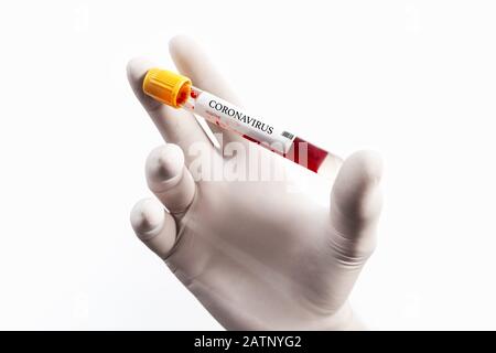 Blood Sample in a flask for analyzing Corona virus and producing vaccine. Corona virus outbreaking Stock Photo