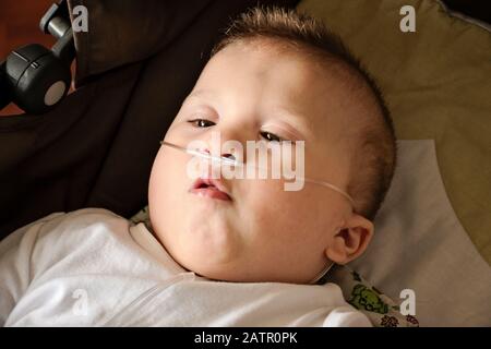 Baby boy with cerebral palsy is getting oxygen via nasal prongs to assure oxygen saturation. Nasal catheter in a child patient in hospital. Stock Photo