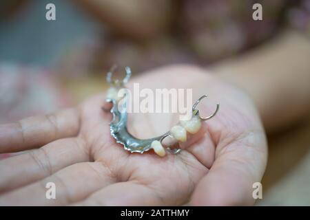 Tooth supported partial denture with metal base in elderly people hand Stock Photo