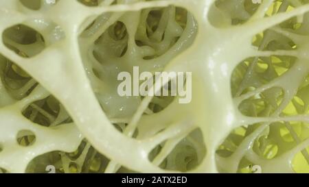 Bone affected with osteoporosis - cross section - 3D rendering Stock ...