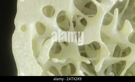 Bone affected with osteoporosis - cross section - 3D rendering Stock ...